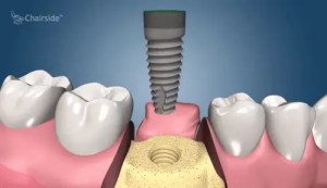 Dentista cerca de mí, dentista cerca de mí, mejor dentista de miami, mejor dentista de miami, pizza cerca de mí, chino cerca de mí, comida cerca de mí, dentista de corona en miami, dentista más barato en miami, dentista de tratamiento de conductos en miami, dentista de tratamiento de conductos en miami más barato